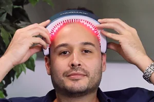 Male pattern baldness