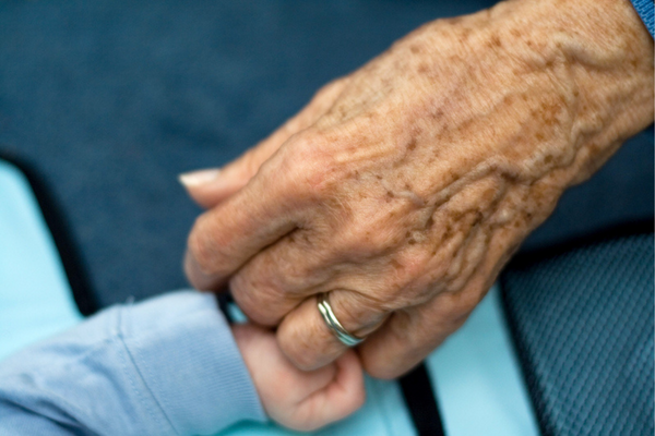 Lentigines (Age Spots/Liver Spots)