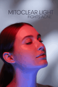 MitoCLEAR Light Fights Acne